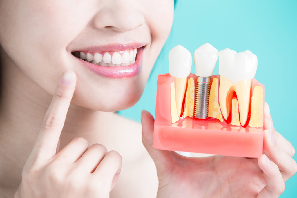 a woman pointing at her teeth while showing a model of a tooth implant