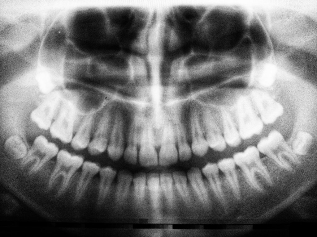 teeth xray